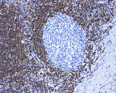 Anti-Bcl2 Mouse Monoclonal Antibody