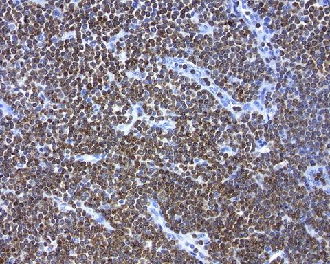 Anti-Bcl2 Mouse Monoclonal Antibody