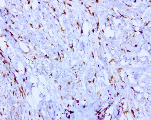 Anti-BMP4 Mouse Monoclonal Antibody