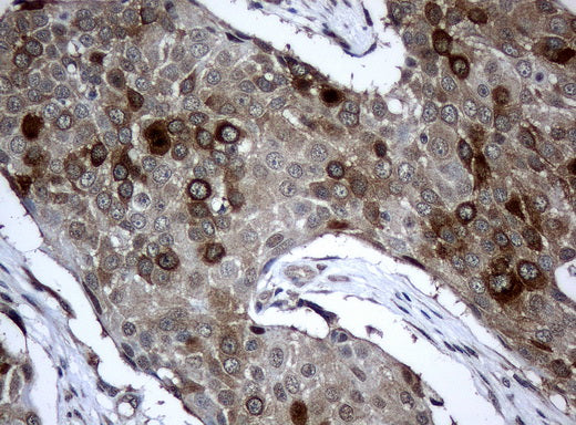 Anti-BUBR1 Mouse Monoclonal Antibody