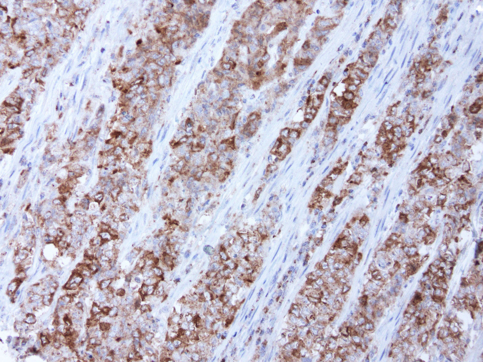 Anti-BUBR1 Mouse Monoclonal Antibody