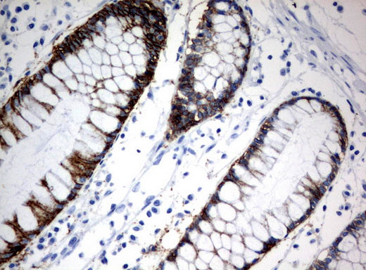 Anti-CA12 Mouse Monoclonal Antibody