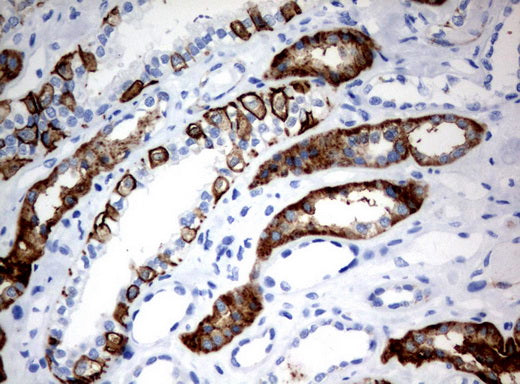Anti-CA12 Mouse Monoclonal Antibody