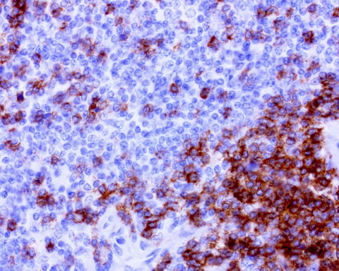 Anti-CD2 Mouse Monoclonal Antibody