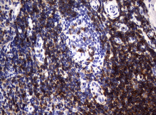 Anti-CD2 Mouse Monoclonal Antibody