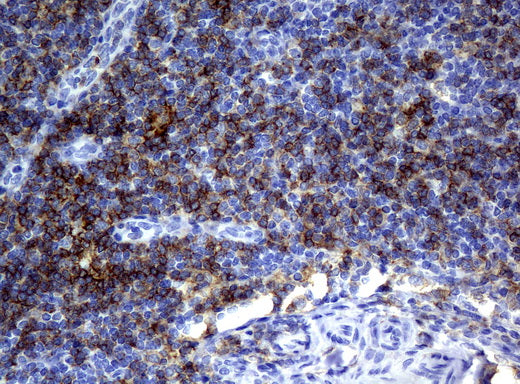 Anti-CD4 Mouse Monoclonal Antibody
