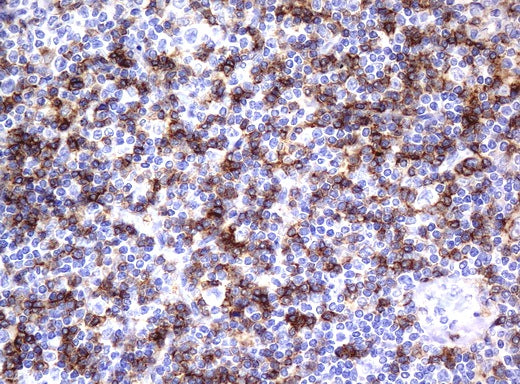 Anti-CD4 Mouse Monoclonal Antibody