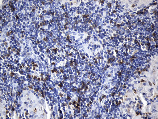 Anti-CD8 alpha Mouse Monoclonal Antibody