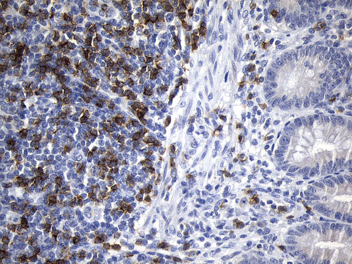 Anti-CD8 alpha Mouse Monoclonal Antibody