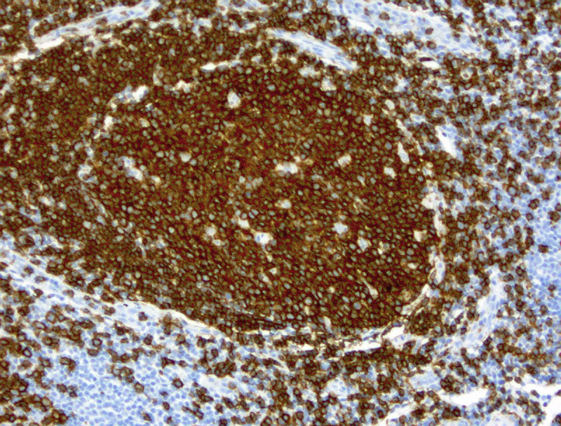 Anti-CD19 Mouse Monoclonal Antibody