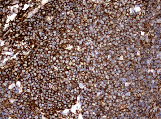 Anti-CD19 Mouse Monoclonal Antibody
