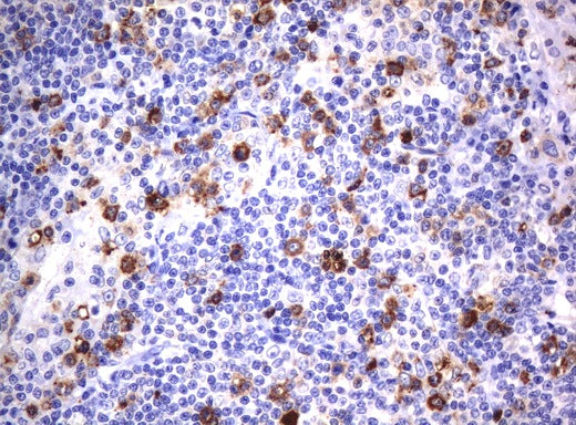 Anti-CD80 Mouse Monoclonal Antibody