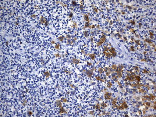 Anti-CD30 Mouse Monoclonal Antibody