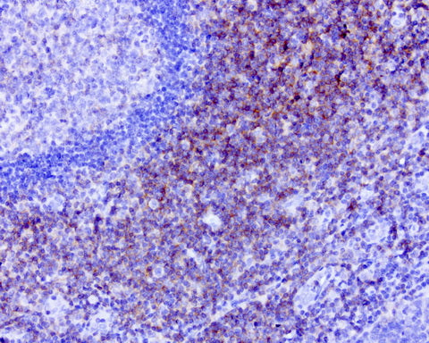 Anti-CD40 Mouse Monoclonal Antibody