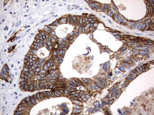 Anti-CD44 Mouse Monoclonal Antibody