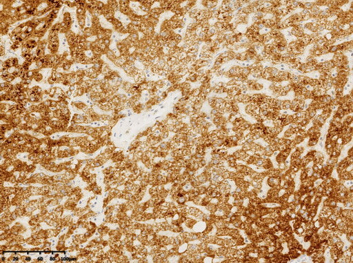 Anti-CPS1 Mouse Monoclonal Antibody