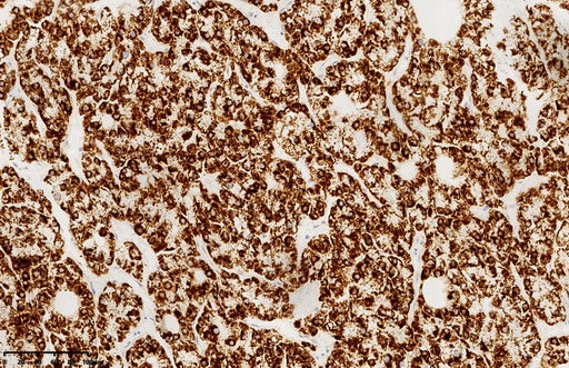Anti-CPS1 Mouse Monoclonal Antibody
