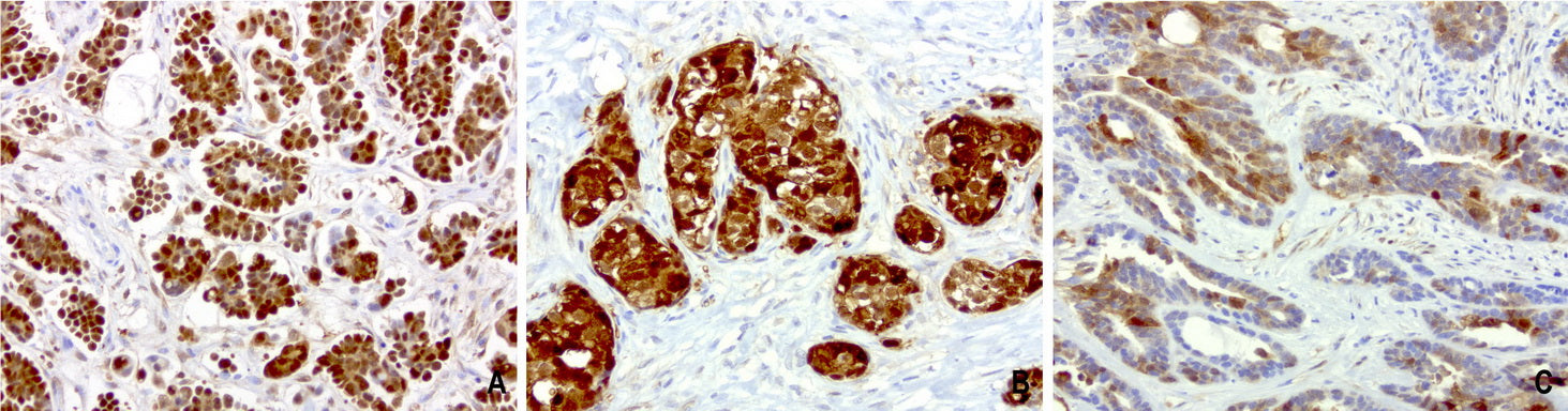 Anti-CRABP2 Mouse Monoclonal Antibody