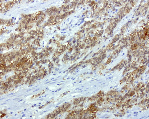 Anti-CRABP2 Mouse Monoclonal Antibody