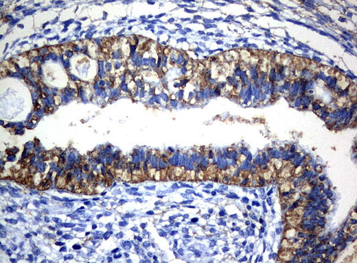 Anti-CTAG1B (NY-ESO-1) Mouse Monoclonal Antibody