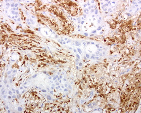 Anti-DOCK2 Mouse Monoclonal Antibody