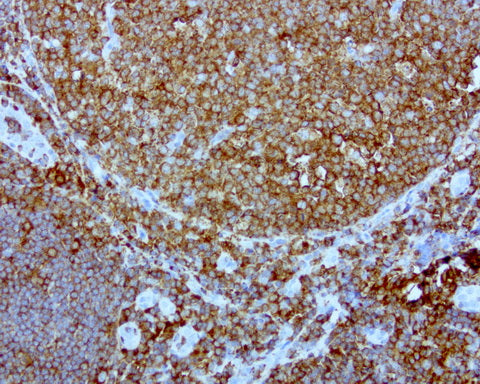 Anti-DOCK2 Mouse Monoclonal Antibody