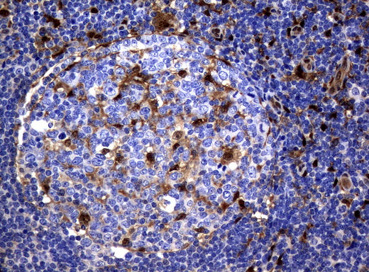 Anti-Thymidine Phosphorylase Mouse Monoclonal Antibody
