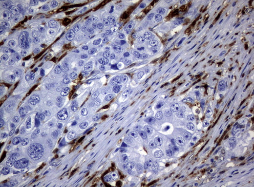 Anti-Thymidine Phosphorylase Mouse Monoclonal Antibody