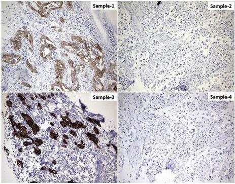 Anti-EGFR Mouse Monoclonal Antibody