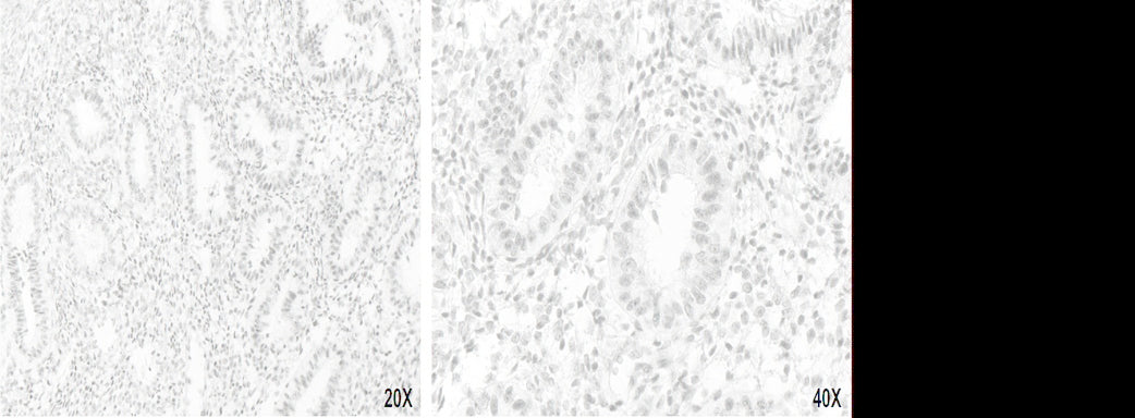 Anti-XPF Mouse Monoclonal Antibody