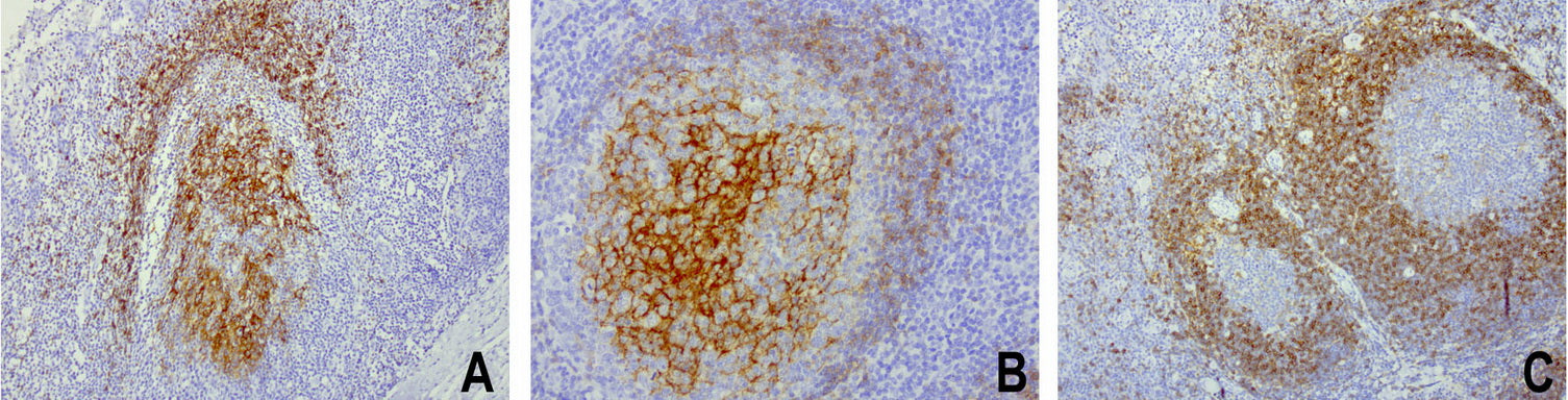 Anti-CD23 Mouse Monoclonal Antibody