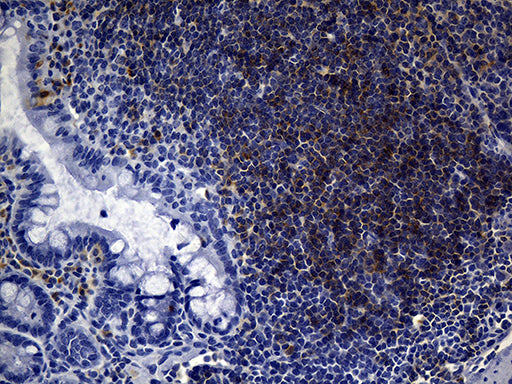 Anti-CD23 Mouse Monoclonal Antibody
