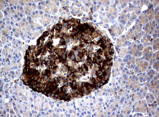 Anti-FCGR1A Mouse Monoclonal Antibody