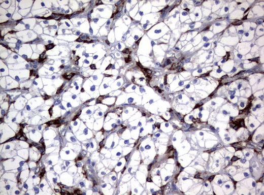 Anti-FCGR1A Mouse Monoclonal Antibody