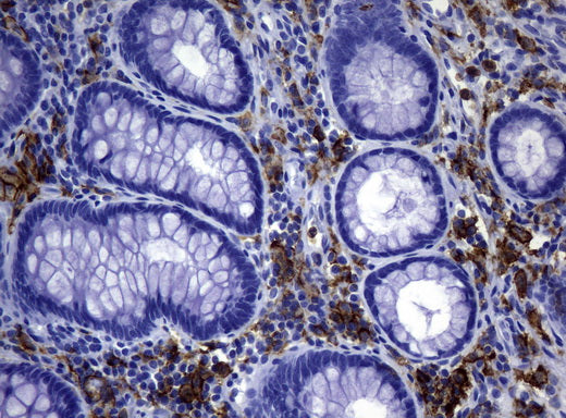 Anti-CD32 Mouse Monoclonal Antibody