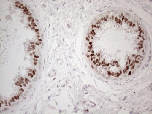 Anti-GATA3 Mouse Monoclonal Antibody