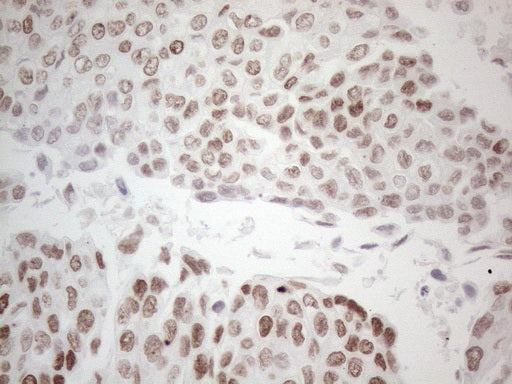 Anti-GATA3 Mouse Monoclonal Antibody