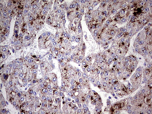 Anti-GBA Mouse Monoclonal Antibody