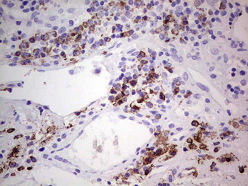 Anti-GLI1 Mouse Monoclonal Antibody