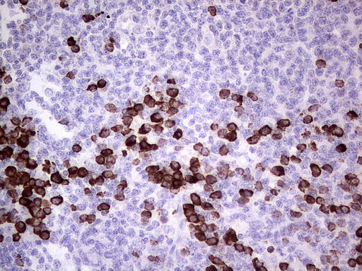 Anti-GLI1 Mouse Monoclonal Antibody