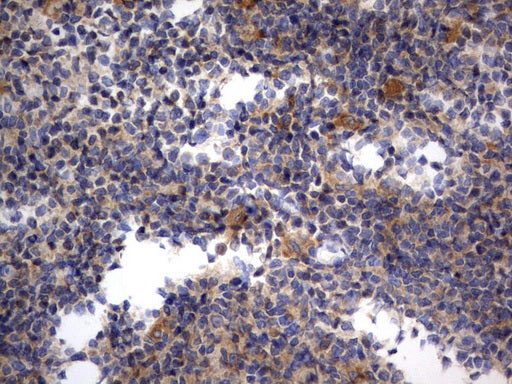 Anti-RAPGEF1 Mouse Monoclonal Antibody