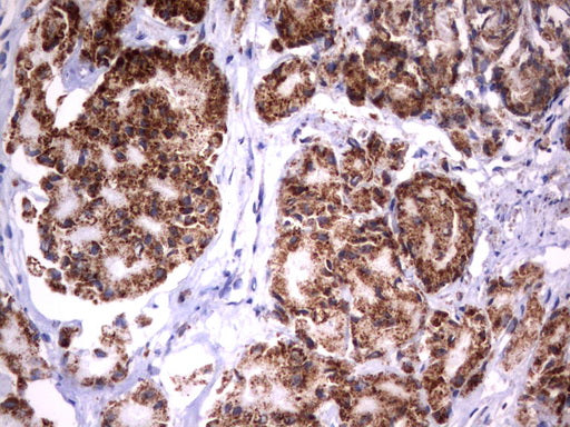 Anti-HADH Mouse Monoclonal Antibody