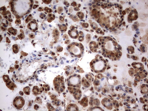 Anti-HMBS Mouse Monoclonal Antibody