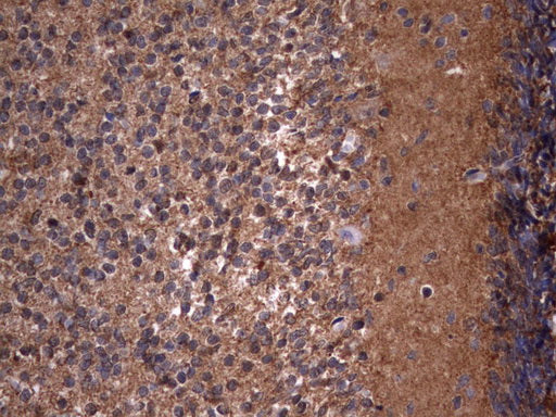 Anti-HMBS Mouse Monoclonal Antibody