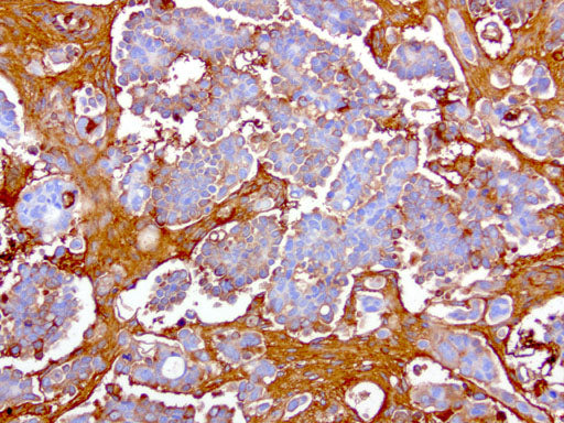 Anti-Haptoglobin Mouse Monoclonal Antibody