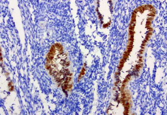 Anti-IRF6 Mouse Monoclonal Antibody