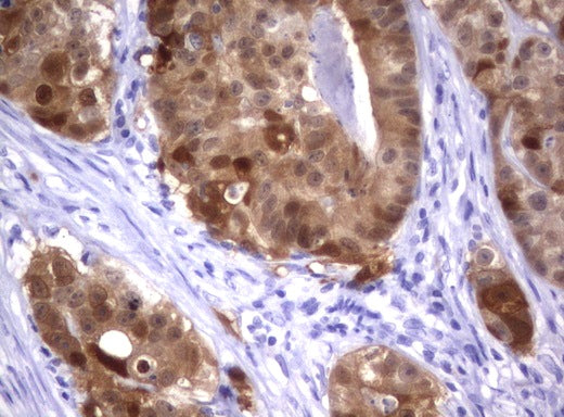 Anti-IRF6 Mouse Monoclonal Antibody