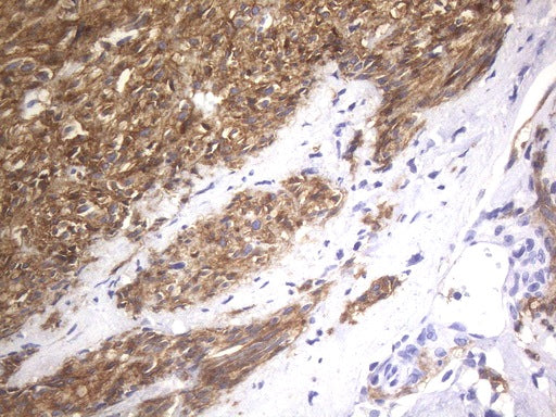 Anti-c-Kit Mouse Monoclonal Antibody