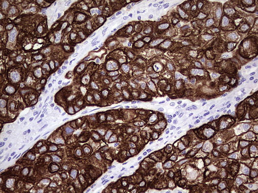 Anti-Cytokeratin 7 Mouse Monoclonal Antibody