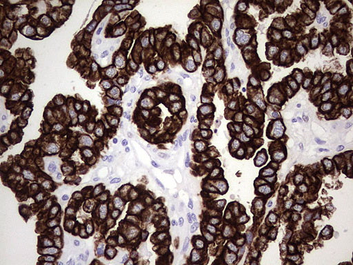 Anti-Cytokeratin 7 Mouse Monoclonal Antibody